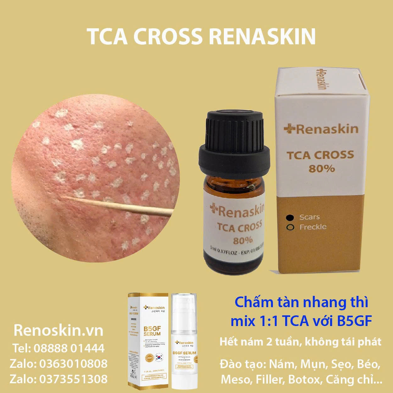 Hướng dẫn quy trình TCA Cross Renaskin