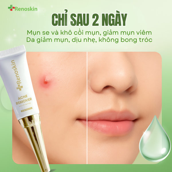 renoskin.vn