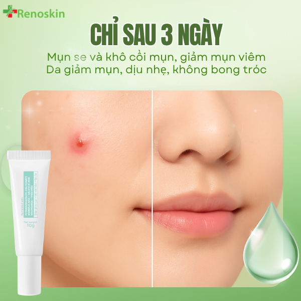 renoskin.vn